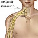 Cervical plexus Nerverna i cervical plexus är