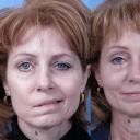 How to correct facial asymmetry: two gymnastics against asymmetry Stars with facial asymmetry